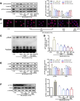 Gentiopicroside Ameliorates Diabetic Renal Tubulointerstitial Fibrosis via Inhibiting the AT1R/CK2/NF-κB Pathway